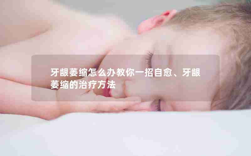 牙龈萎缩怎么办教你一招自愈、牙龈萎缩的治疗方法