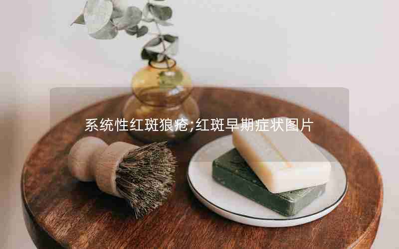 系统性红斑狼疮;红斑早期症状图片